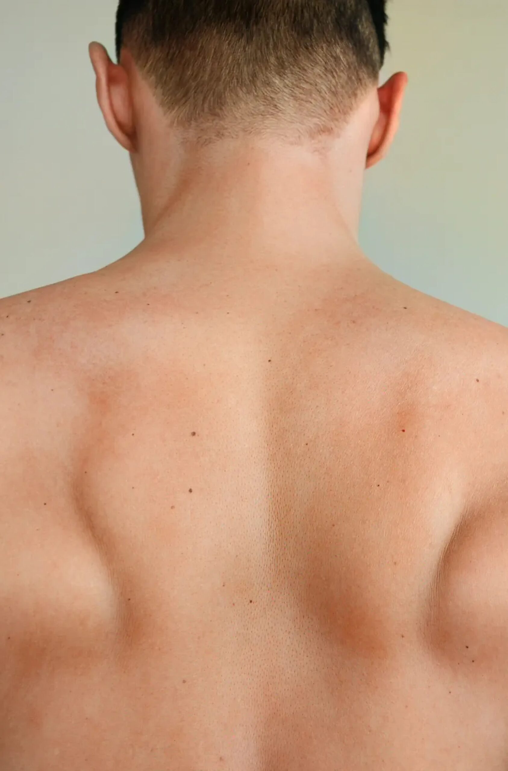 Forward-facing image capturing the back and neck of an individual